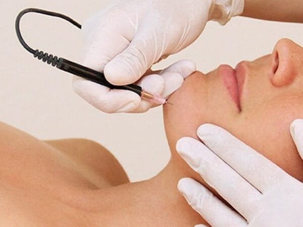 close up of woman's face getting beauty treatment